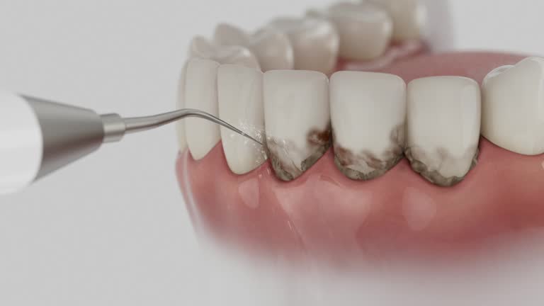 Trusted Teeth Cleaning And Checkup service in Parker City, IN - Dentist Open Now